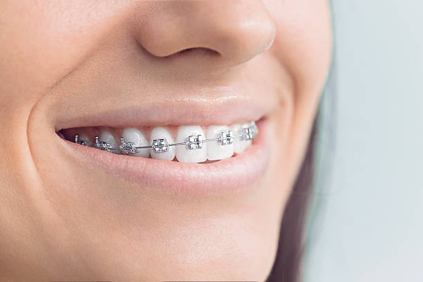Dental Inlays and Onlays in San Augustine, TX